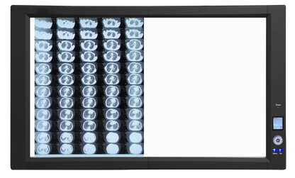 Trimline LED Illuminator