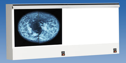 VuPlus Mammography Viewer