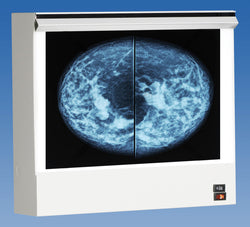 VuPlus Mammography Viewer